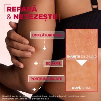Crema regeneratoare pentru fata si corp Mixa Urea Cica Repair cu 10% Uree si Niacinamida, piele uscata, descuamata, cu denivelari, 400 ml