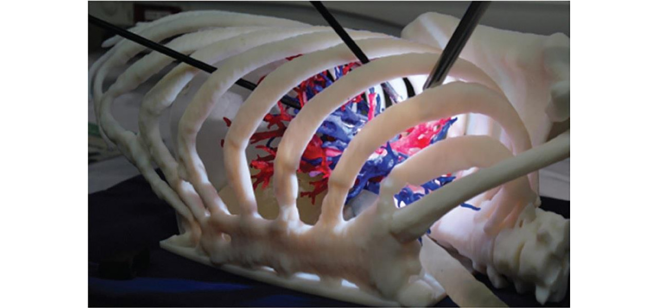 Modele imprimate 3D care imbunatatesc vizualizarea in educatia medicala.