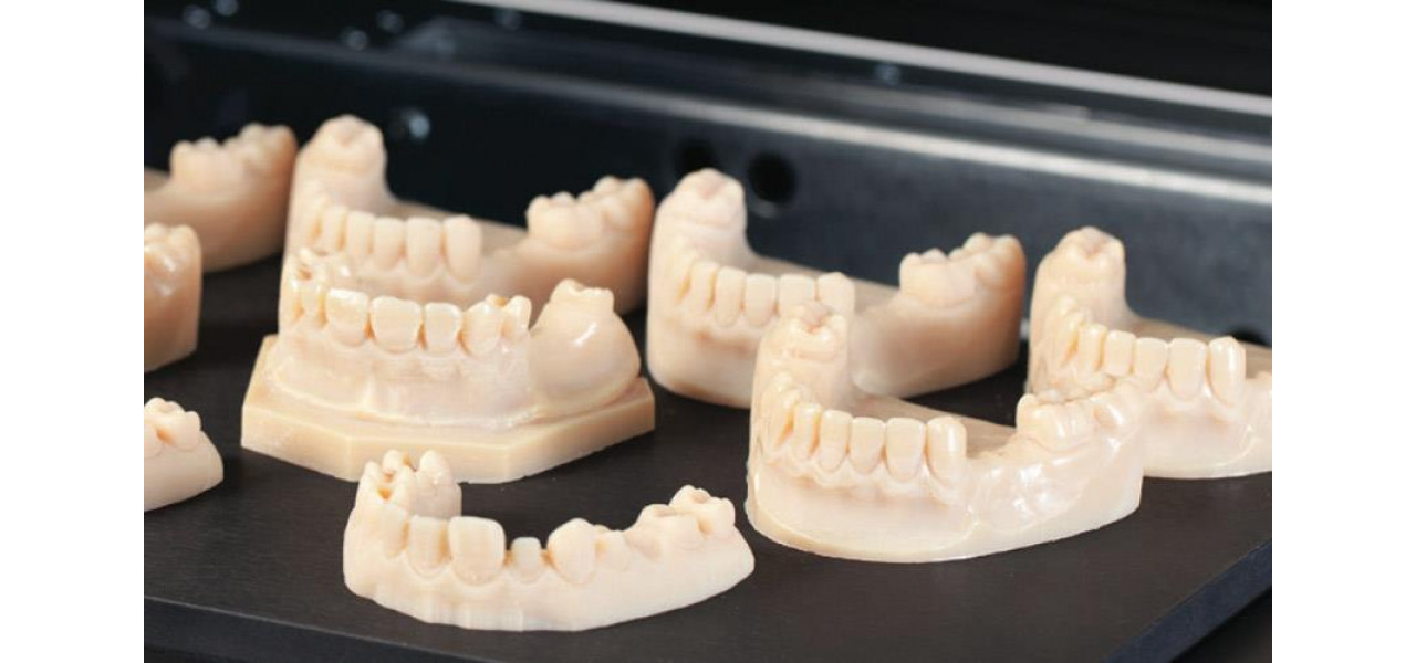 Imprimarea 3D in stomatologie revolutioneaza ingrijirea orala.